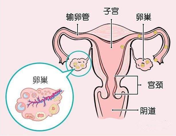 卵巢储备功能下降怎样才能确诊